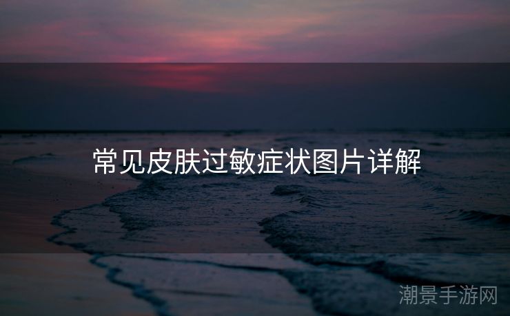 常见皮肤过敏症状图片详解